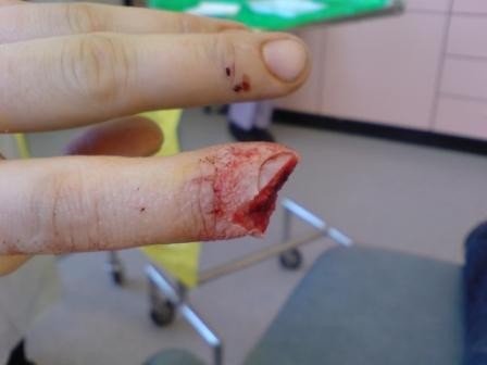finger.jpg